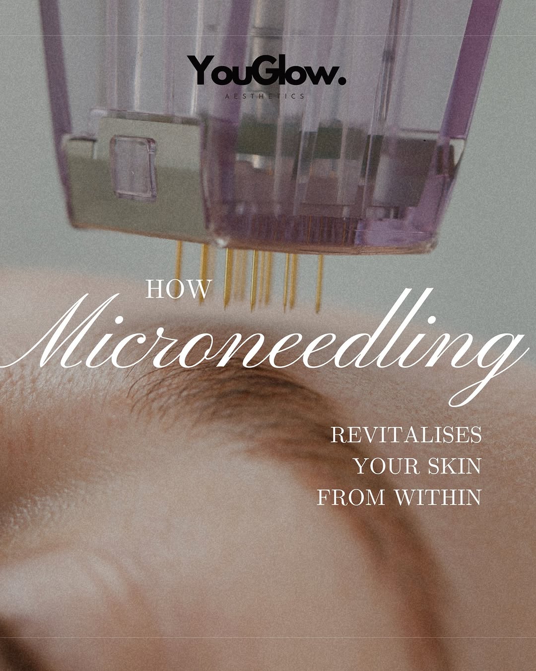 584401514_17869198224472128_4317985313734948921_n