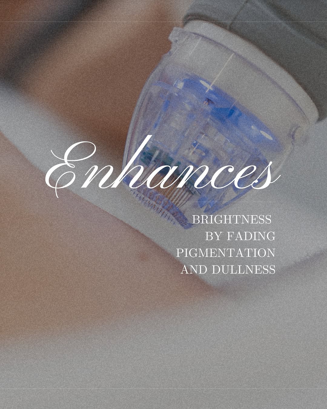 587111882_17869198233472128_4652092933299772914_n