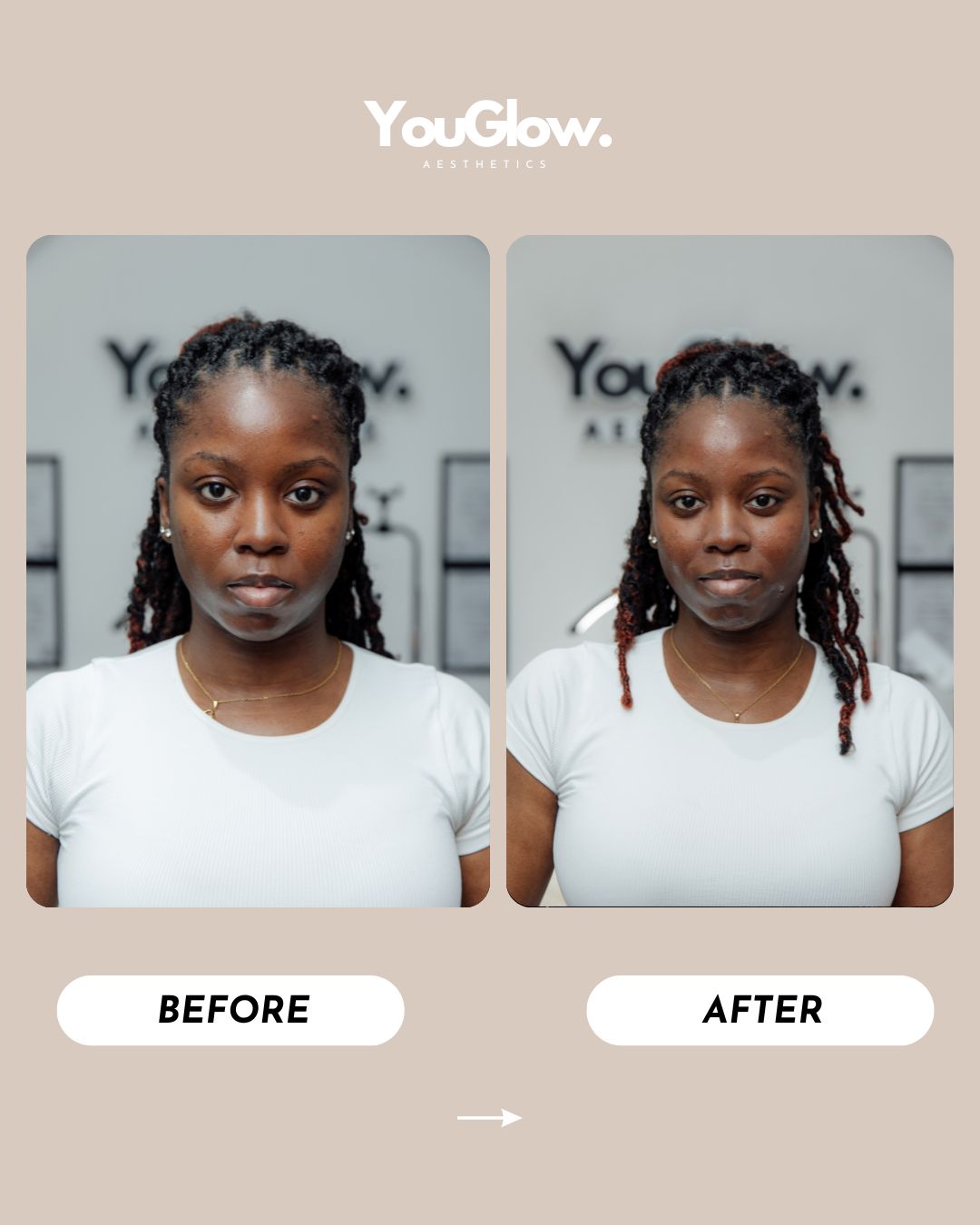 YouGlow File 2 (3)